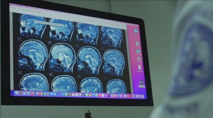 Remédio em estudo parece retardar progressão de Alzheimer, mas segurança preocupa