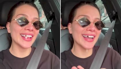 Flavia Pavanelli fica “banguela” após lente de contato dental cair